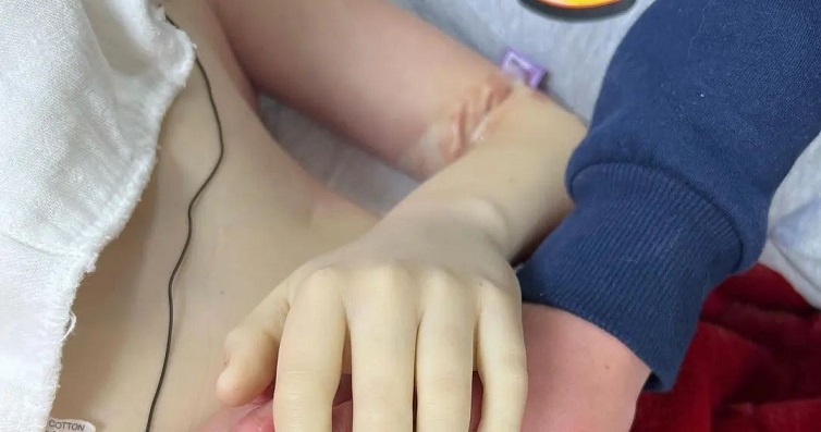 El caso de acoso a una niña venezolana que alarmó a Perú: Compañeros quemaron el rostro