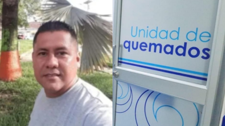 Murió tras un mes de agonía