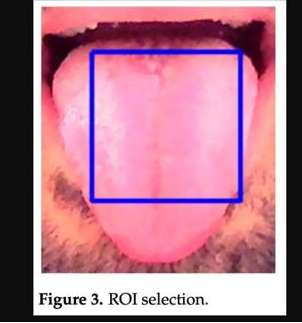 Desarrollan modelo de IA que detecta enfermedades a través del color de la lengua