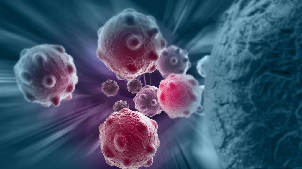 Asistente de IA ayuda a detectar cáncer