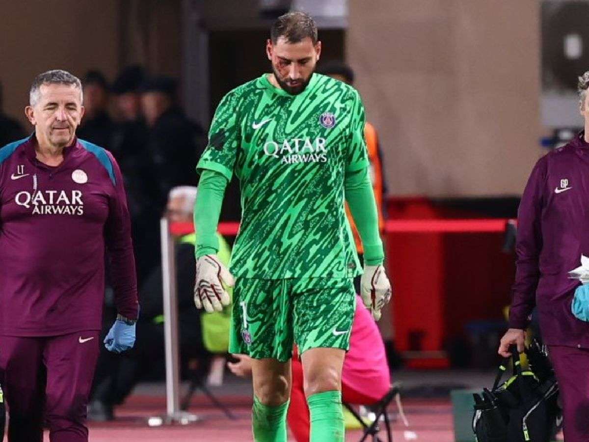 Donnarumma sufrió traumatismo facial tras golpe de Singo