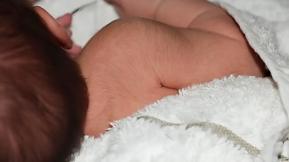 Crecen vellos a bebés que tienen contacto con minoxidil