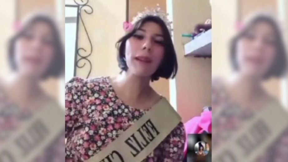 Falleció la joven zuliana que se quemó en vivo por un reto de TikTok