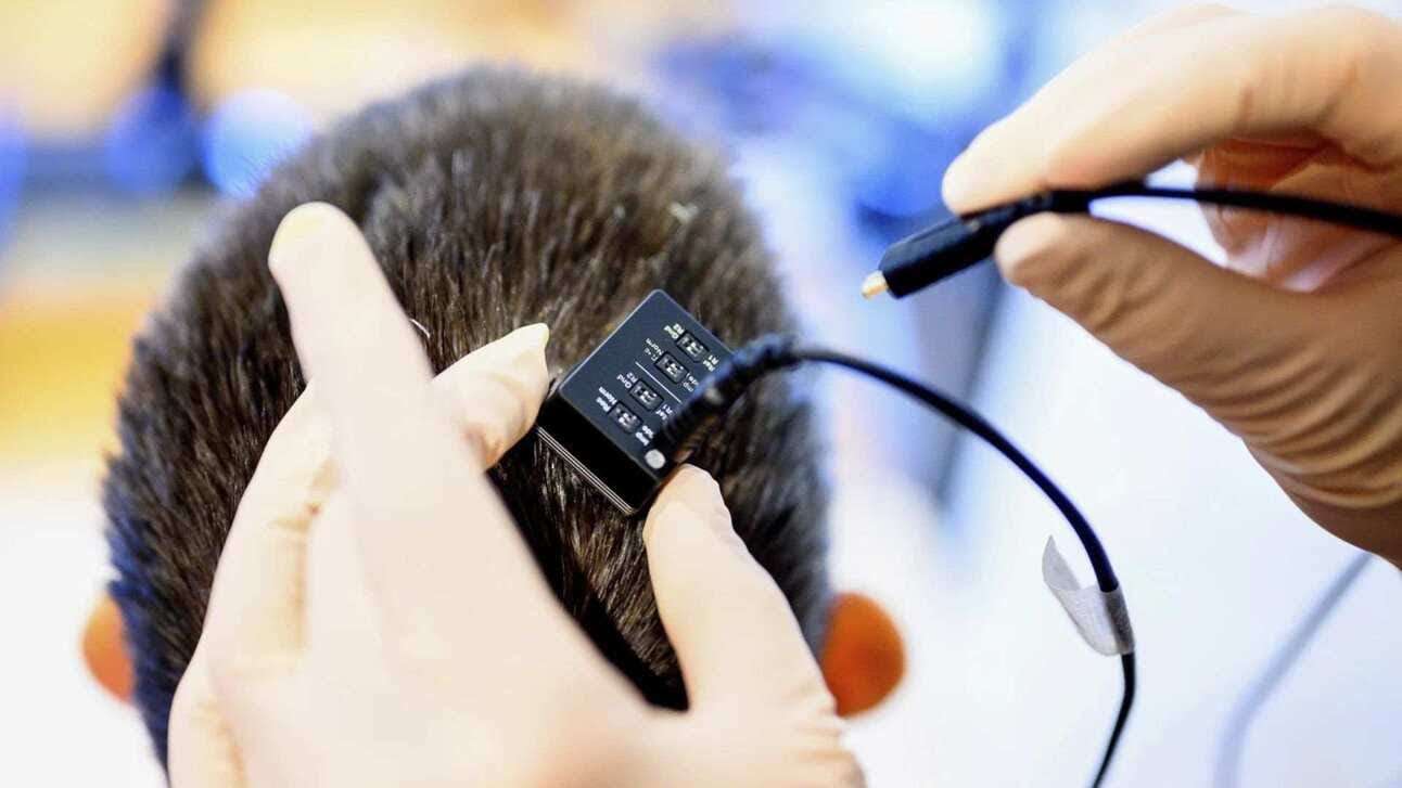 Investigadores usaron un chip de IA para traducir los pensamientos en palabras
