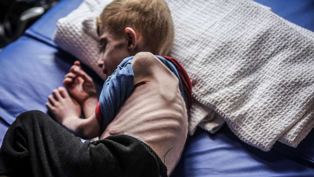 OMS: 57 niños habrían muerto por desnutrición en Gaza en dos meses