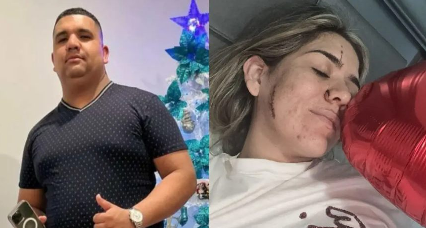 Rompió el silencio la venezolana que sobrevivió a 28 puñaladas de su expareja