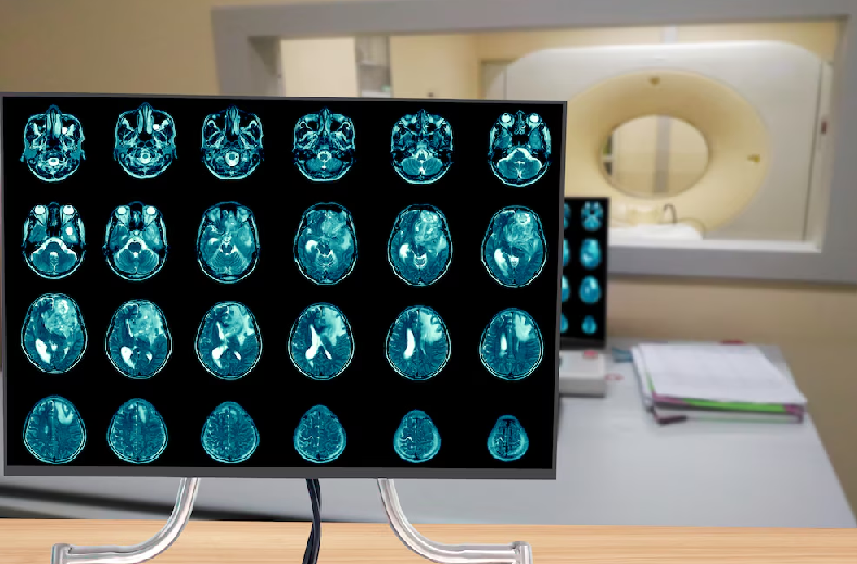 escáneres cerebrales revelan el rasgo que tienen en común