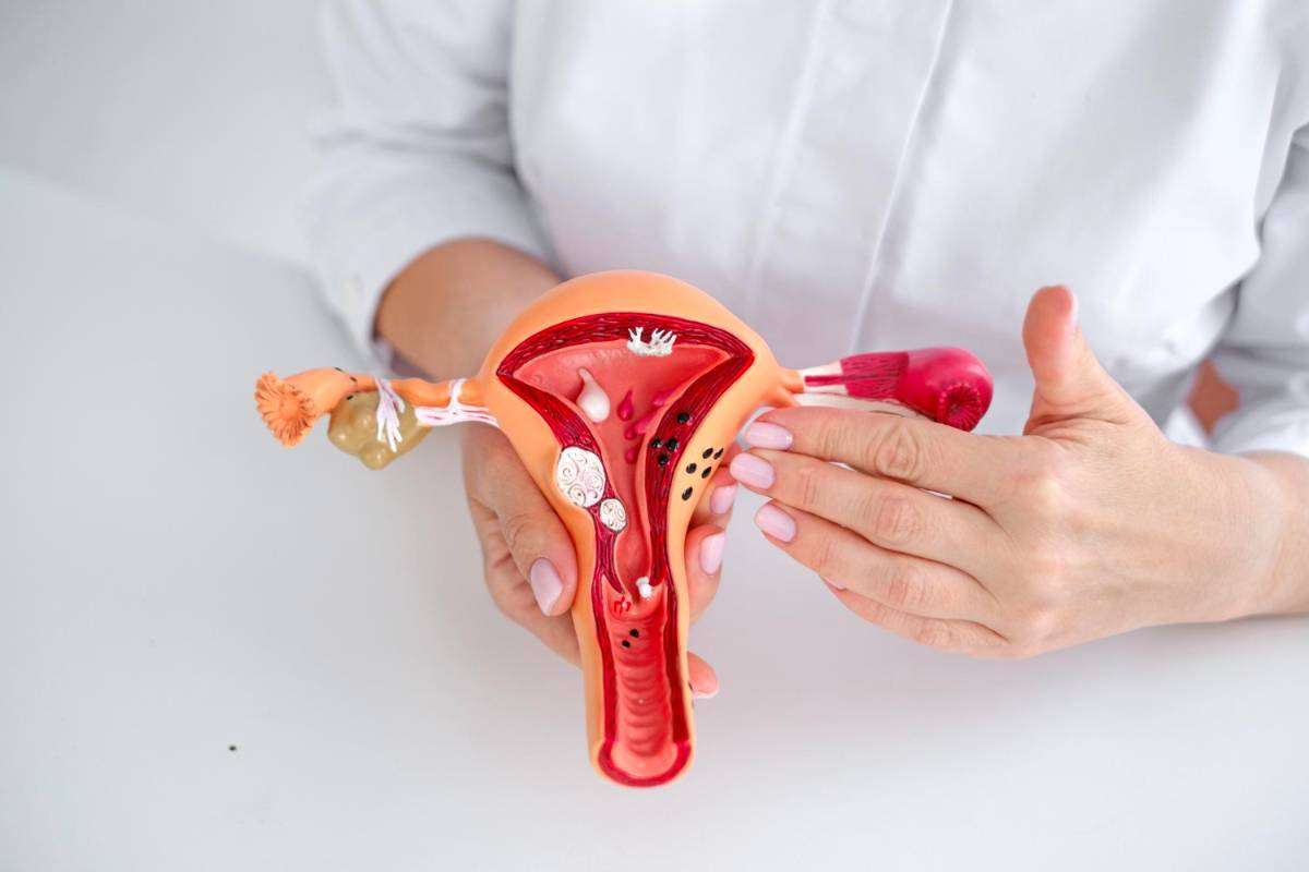 Endometriosis, una enfermedad silenciosa - Últimas Noticias