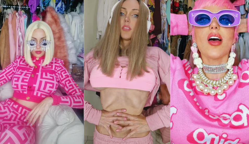 27 cirugías y 48 mil euros en retoques para ser “Barbie”