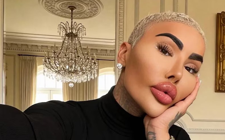 Murió Jordan James Parke, el influencer conocido como el 'Rey de los labios' que se quería parecer a Kim Kardashian