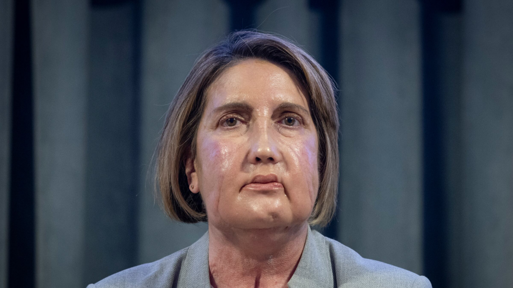 Realizan el primer trasplante de cara con donante que recibió la eutanasia